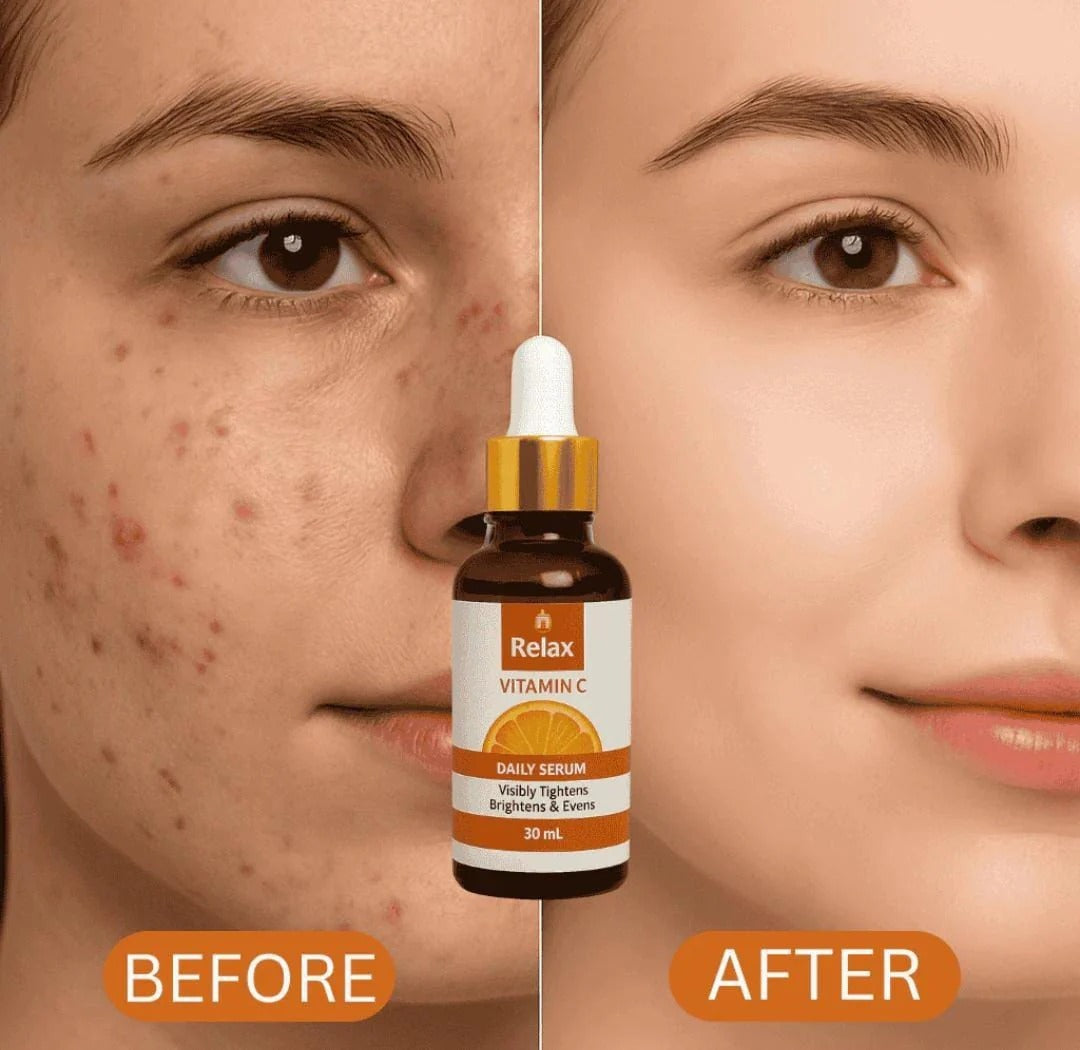 Relax Vitamin C Daily Serum - 30ml | Visibly Brightens, Evens Skin Tone
